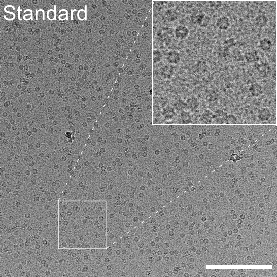 cryo electron micrograph with standard preparation